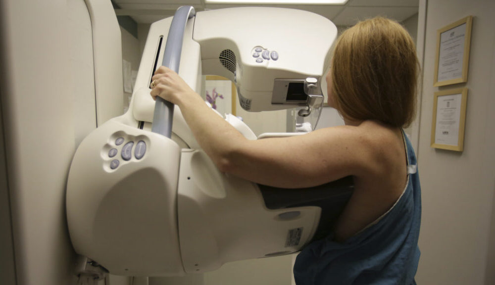 Regular mammograms should start at age 40, the national group says