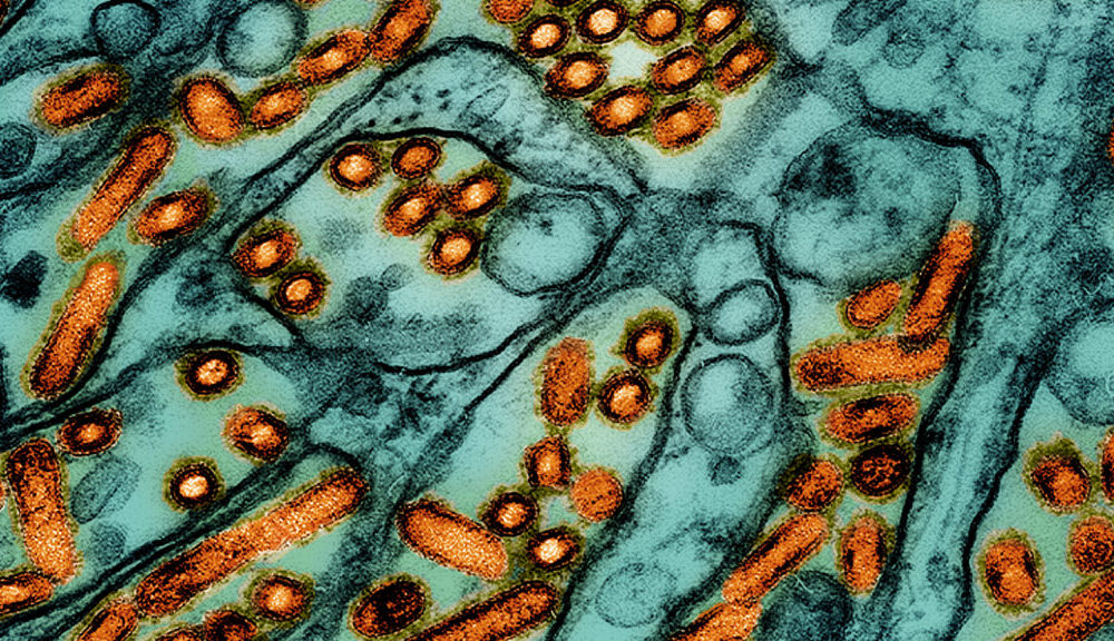 H5N1 bird flu outbreak: Second human case reported, in Michigan