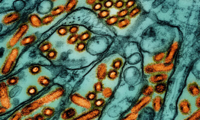 H5N1 bird flu outbreak: Second human case reported, in Michigan
