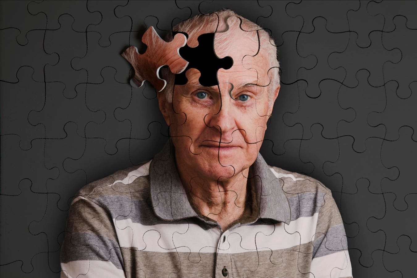 How to prevent Alzheimer's disease: a case for vaccines