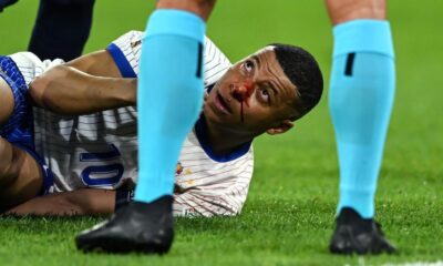 Kylian Mbappe broke his nose during France's 2024 Euro 2024 victory over Austria and may need surgery, reports say
