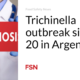 Trichinella outbreak sickens 20 people in Argentina