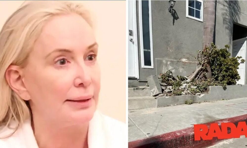 Shannon Beador's bloodied face from car crash revealed in shocking photo