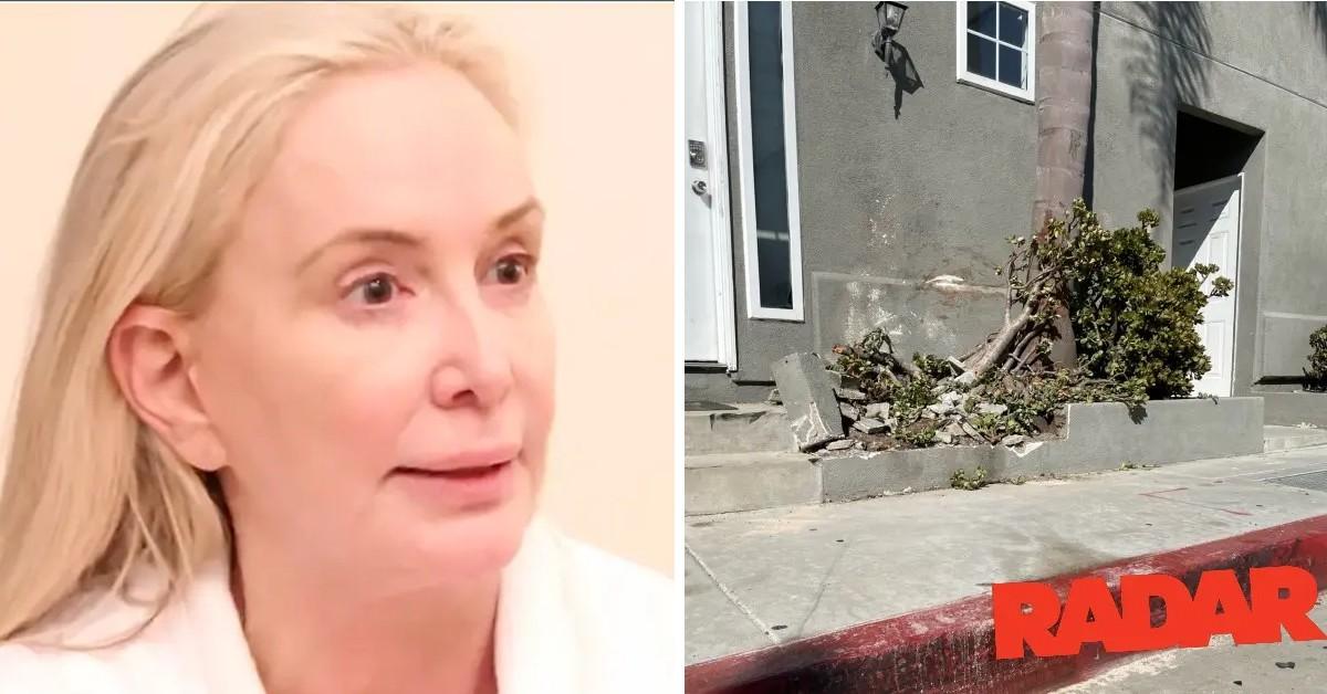 Shannon Beador's bloodied face from car crash revealed in shocking photo