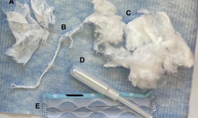The first study measuring toxic metals in tampons shows arsenic and lead, among other contaminants
