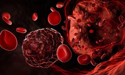 The push for universal blood cancer therapy
