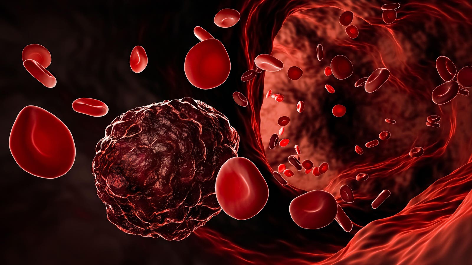 The push for universal blood cancer therapy