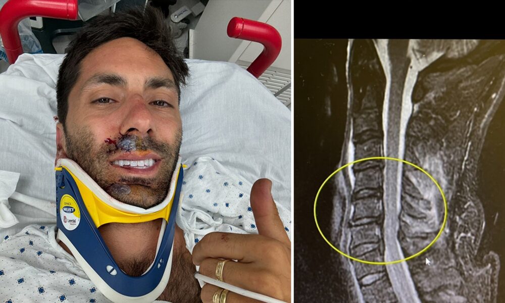 Nev Schulman breaks neck in bicycle accident